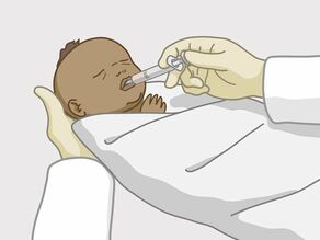 De baby krijgt medicijnen na de geboorte. 