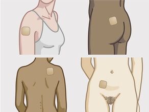 Aplique el parche en el abdomen, el glúteo, la espalda, el omóplato o en el exterior de la parte superior del brazo, sobre la piel seca y limpia.