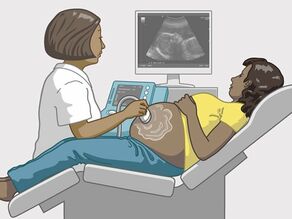 De dokter maakt minstens 3 echografieën tijdens de zwangerschap.