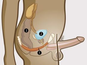 Oversikt over mannens bekken i detalj: 1. bekkenbunnsmuskulaturen som støtter 2. blæren og 3. tarmen.