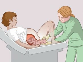 The baby is usually delivered naturally. 
