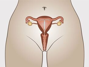 Pajisja IUD e vendosur në mitër. 2 fije të shkurtra janë lënë majtas lart në vaginë, jashtë mitrës.