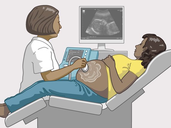 En lege gjennomfører en ultralydundersøkelse på en gravid kvinne.