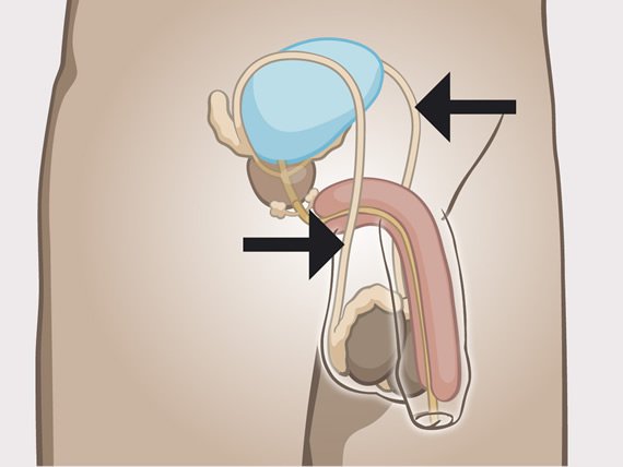 Man's internal sexual organs with indication of the sperm ducts
