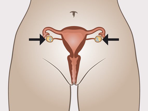 Organes sexuels internes de la femme avec indication des ovaires