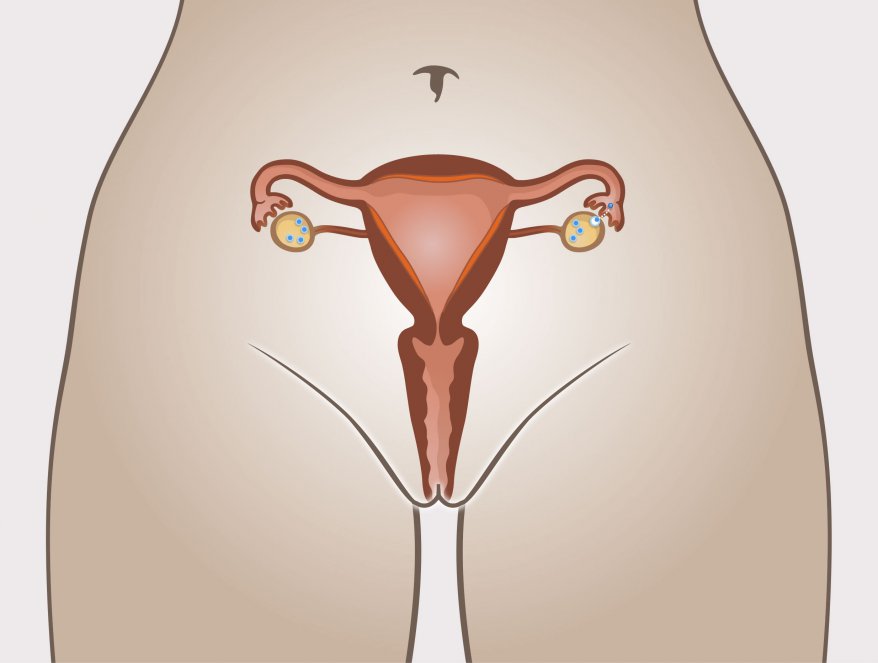 Organes sexuels internes de la femme où l’on voit comment se passe une ovulation dans l’un des ovaires